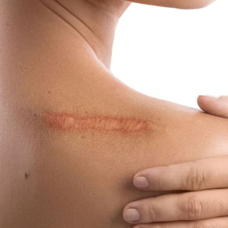 Dermopigmentation - Life Repair