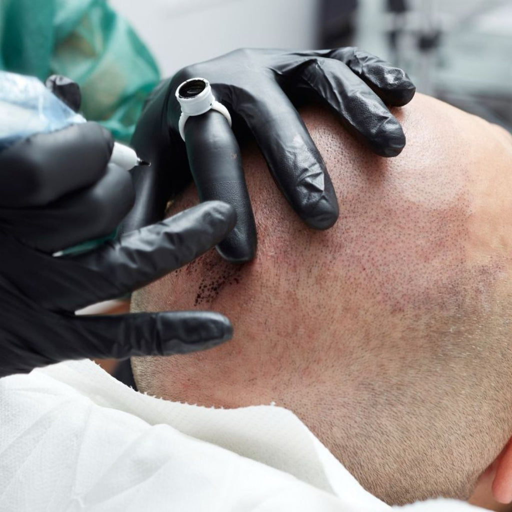 Technique similaire micropigmentation cheveux