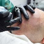 Technique similaire micropigmentation cheveux